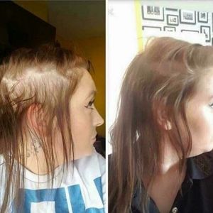 PRE-ORDER ONLY Scalp & Hair System